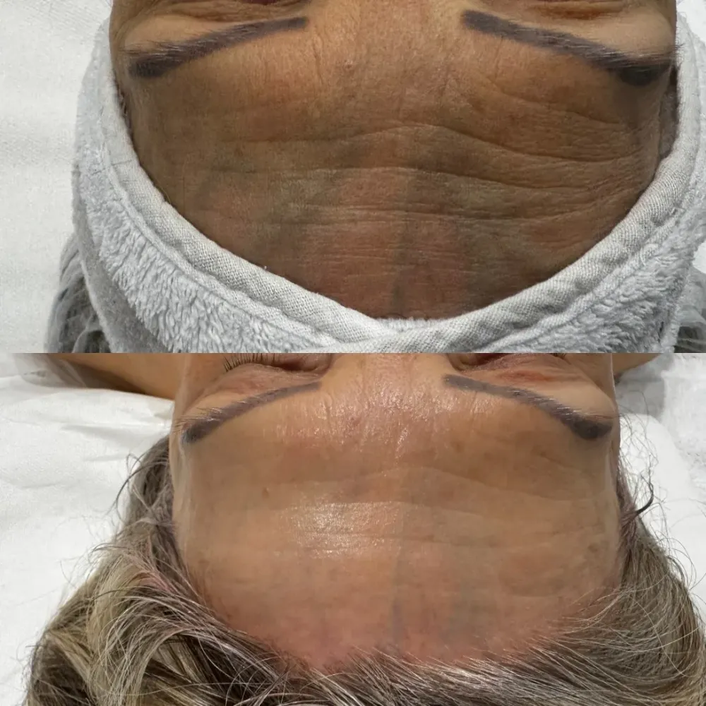 Soins visage ménopause près de Dreux